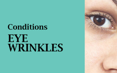 EYE WRINKLES