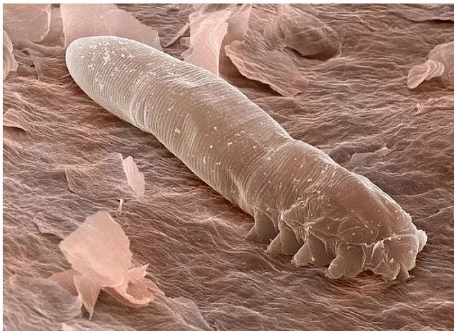 The Tiny Mites That Live in Our Skin